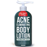 TreeActiv Acne Eliminating Body Lotion 8oz bottle front aiding acne-prone skin hydration