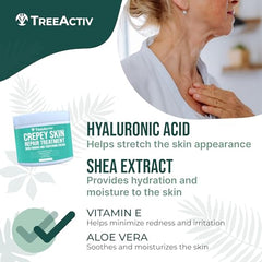 TreeActiv Crepey Skin Repair Cream applied to neck area for smoothing