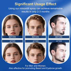 Trzsfr minoxidil formula highlights biotin keratin and castor oil for hair nutrition