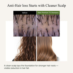 TS SHAMPOO creamy texture close-up emphasizes sulfate-free cleansing