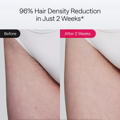 Ulike Air 10 SkinSensor detects skin tone for safe use