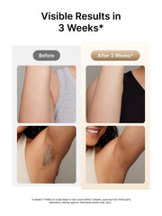 Ulike Air 3 Auto-Glide mode enables fast full-body treatment