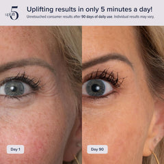 upLift 5 face-contouring-massage during use helps define cheekbones and jawline non-invasively.