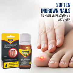 URIEL Upgraded ingrown toenail corrector tool ready for gentle realignment