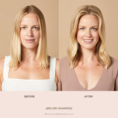 VEGAMOUR GRO Dry Shampoo root-application spray provides instant lift and volume