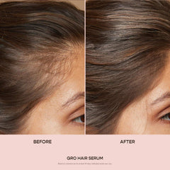 VEGAMOUR GRO Hair Serum dropper applying serum to scalp for even coverage.