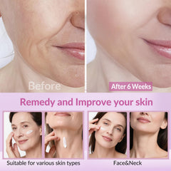VicGFHS neck cream with hyaluronic acid ingredients displayed for deep hydration