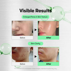 VT COSMETICS Reedle Shot zero-step concept suggesting glass skin clarity