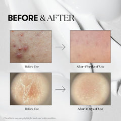 VT COSMETICS Reedle Shot 700 bottle revitalizes natural glow and vitality