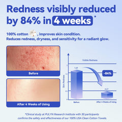 Winner Face Towels ultra-soft cotton surface for makeup removal without irritation