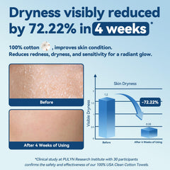 Winner soft face towels cloud-soft cotton closeup emphasizes ultra-soft daily cleansing.