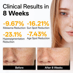 WNP Vitamin C Serum drops ready for application, promoting even skin tone and brightening.