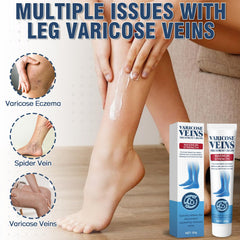 Wonshine varicose veins cream leg massage close-up shows upward rubbing for circulation.