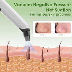 Xamoca USB rechargeable vacuum with battery display for convenient charging