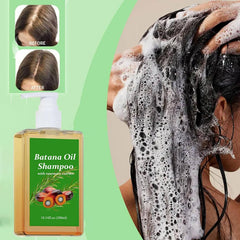 XIKRO Rosemary Extract Shampoo label closeup signals vitality-boosting ingredients for scalp