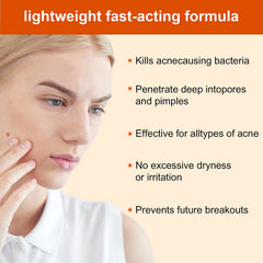 Packaging image of YAFUSIPE acne treatment cream showing brand details.