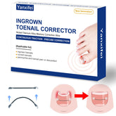 Yanxifei nitinol ingrown toenail corrector kit packaging shows easy setup for home relief.