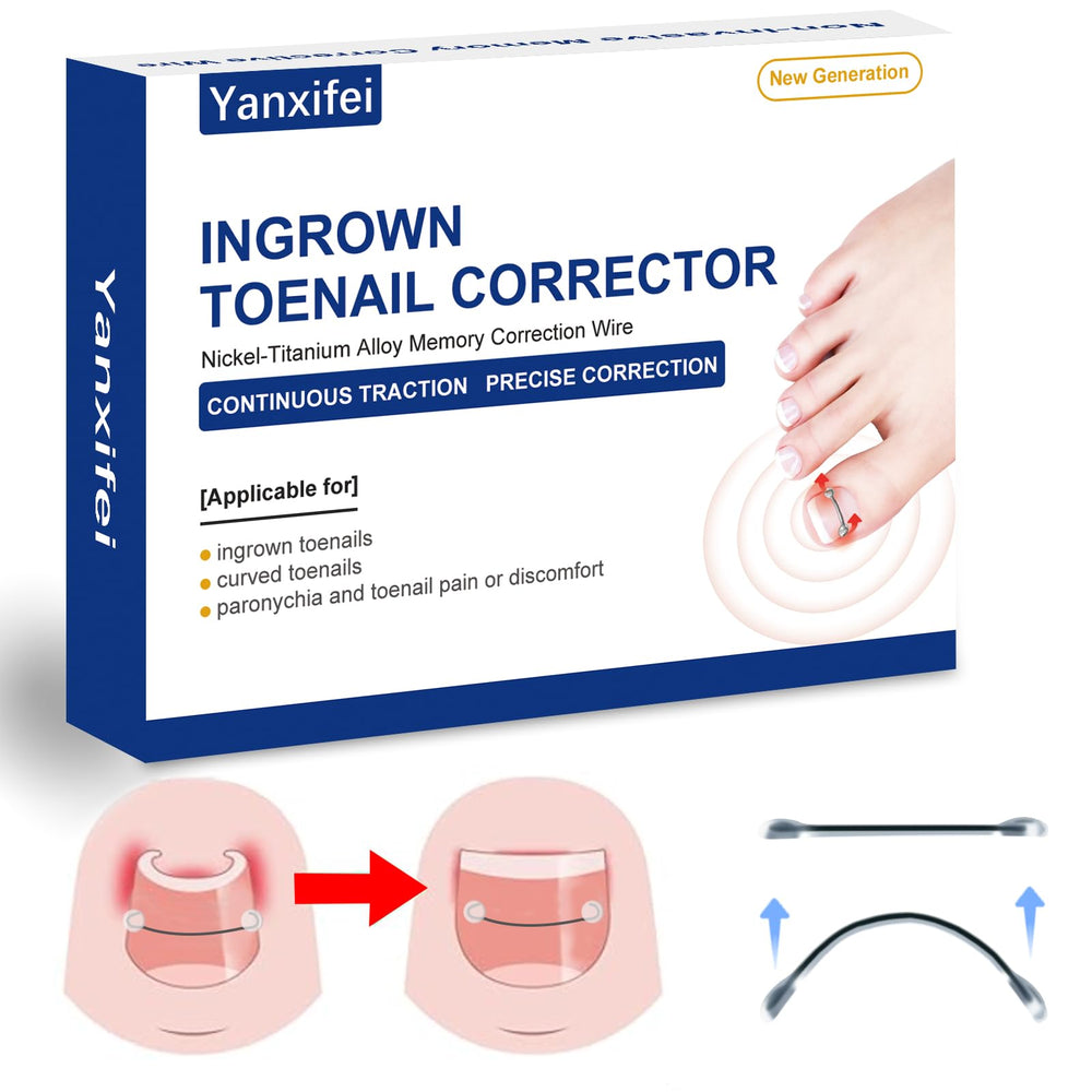 Yanxifei nitinol ingrown toenail corrector set shown for at-home treatment relief