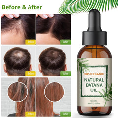 YBW Batana Oil ofrece nutrición diaria para cabello y cuero cabelludo.