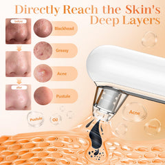 Yccu Blackhead Remover Vacuum USB-C charging for easy recharging