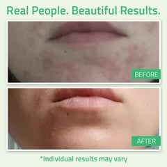 YEOUTH green tea retinol exfoliant emphasizes antioxidant support for refreshed skin.