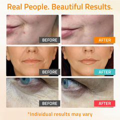 YEOUTH hyaluronic acid serum 99% pure for moisture and plumpness