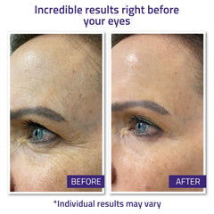 YEOUTH Instant Face Lift Cream under eye area being dabbed for lifting effect.