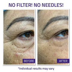 YEOUTH Instant Face Lift Cream targets under eye wrinkles for smoother appearance.