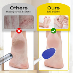 Yomanta foot file with ergonomic-handle stays comfortable in wet or dry use.