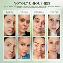 YOYORY eye patches jar closeup emphasizes premium formula and luxurious feel