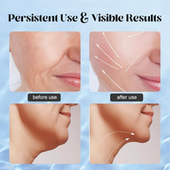 YUNRUO face-massager cap removed indicating proper setup before use