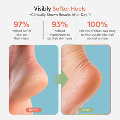 Vitamin E, olive oil and jojoba oil nourish ZenToes sock-lined gel area.