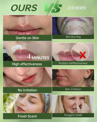 Zeponyx rapid 4-minute depilation for fast facial hair removal