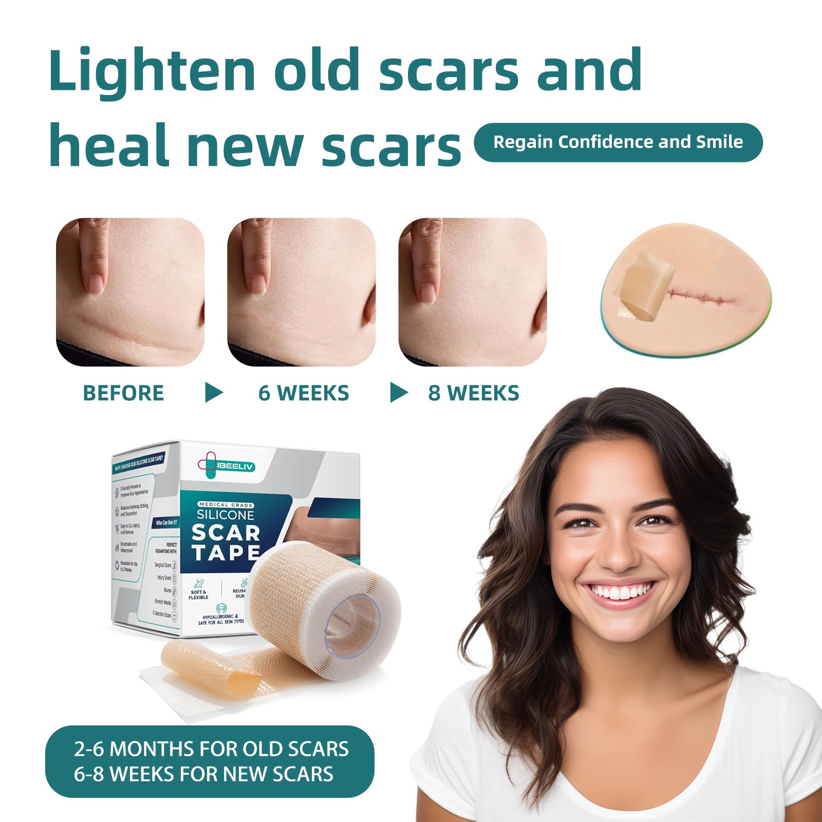 IBEELIV silicone scar gel sheets face and keloid focus for improved texture.