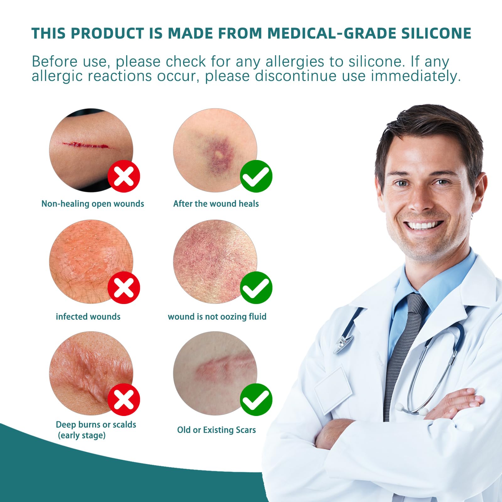 IBEELIV silicone scar gel sheets old vs new scars demonstrate broad compatibility.