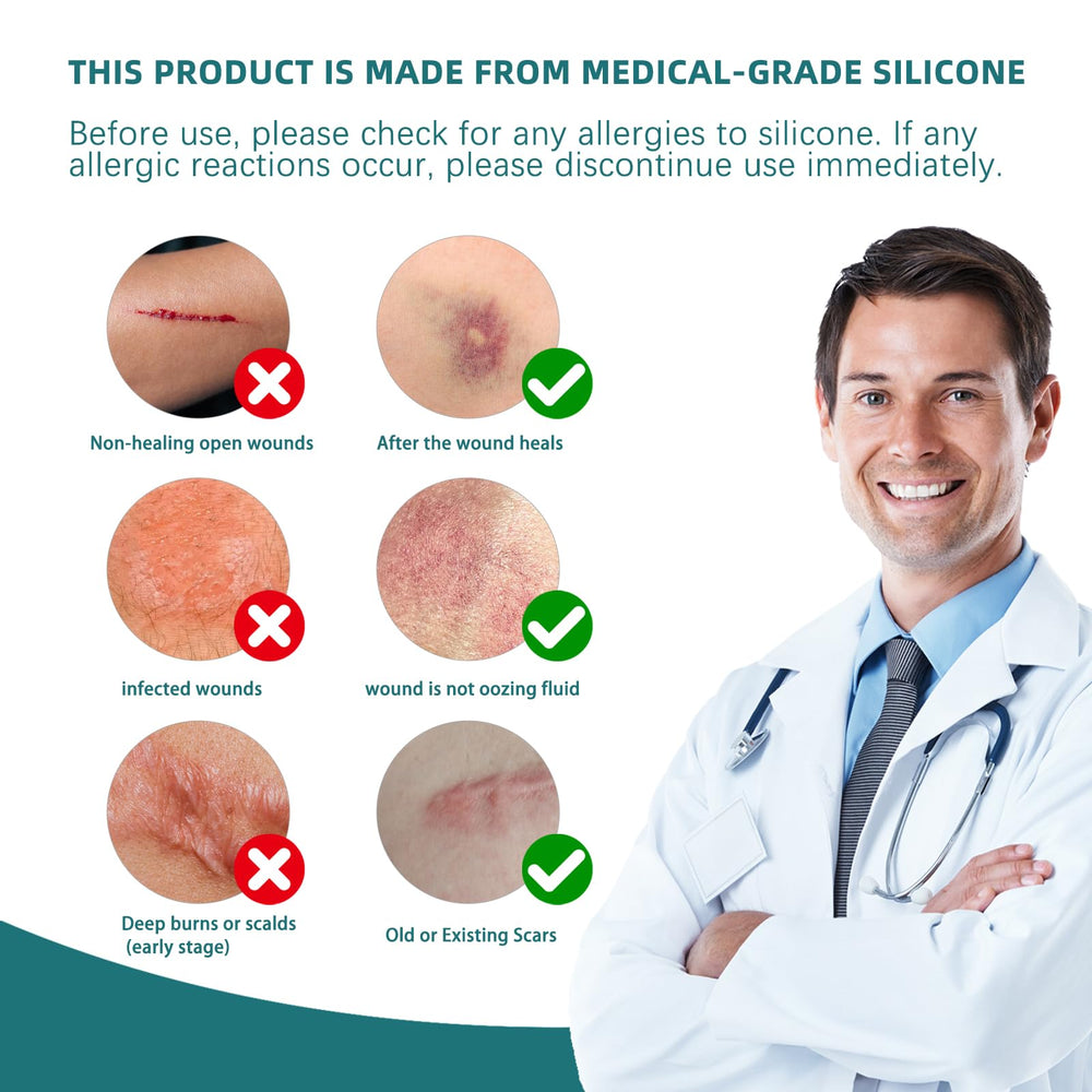 IBEELIV silicone scar gel sheets old vs new scars demonstrate broad compatibility.