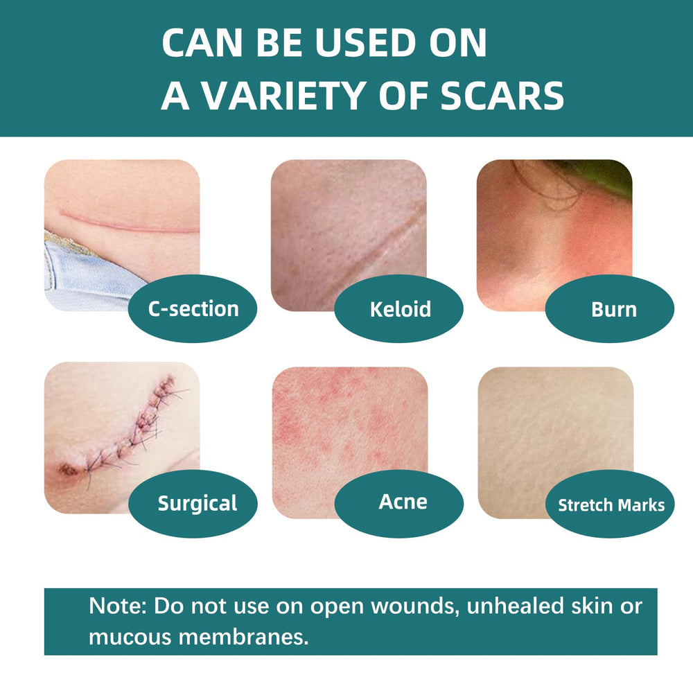 IBEELIV silicone scar gel sheets waterproof design stays in place during daily activities.