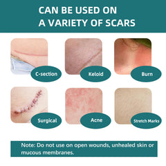 IBEELIV silicone scar gel sheets waterproof design stays in place during daily activities.