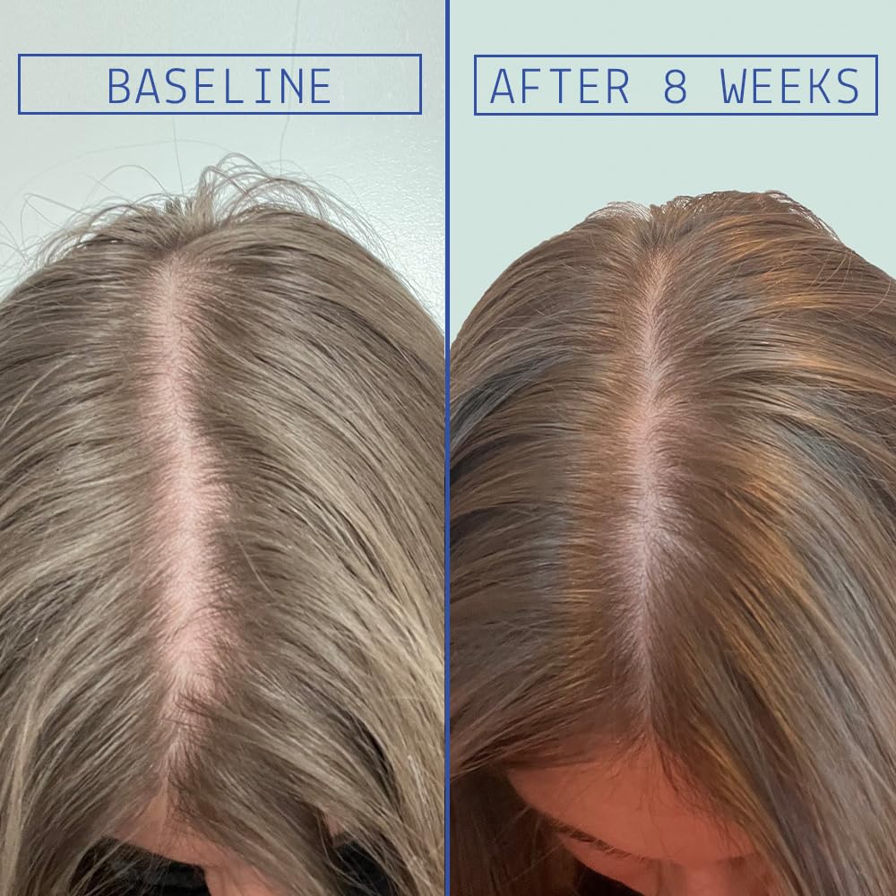 AAVRANI Hair Density Treatment scalp-application demonstrates easy 2-3 drop usage for targeted areas.