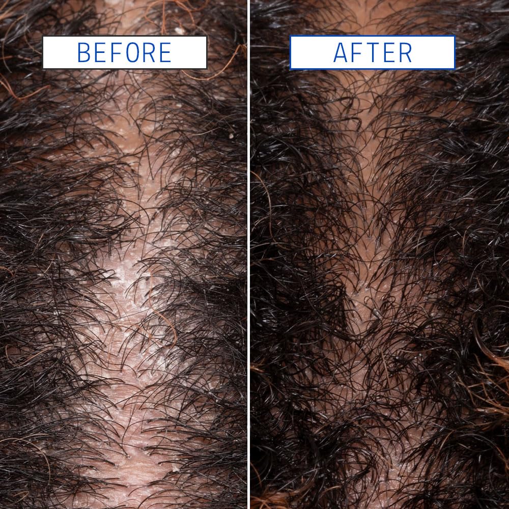 AAVRANI scalp-scrubber accessory enables deeper cleansing.