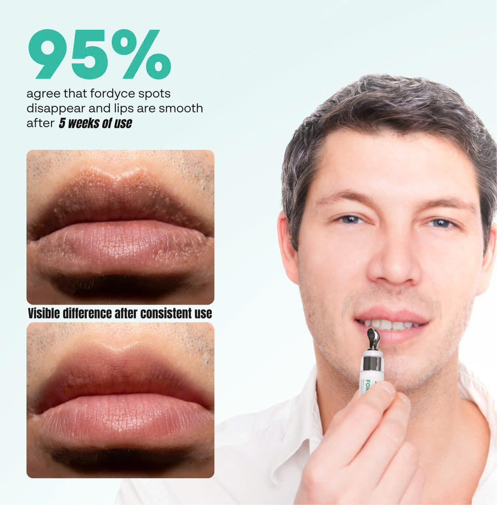 ABERA Fordyce Cream lips-moisturized closeup emphasizes hydrated lips