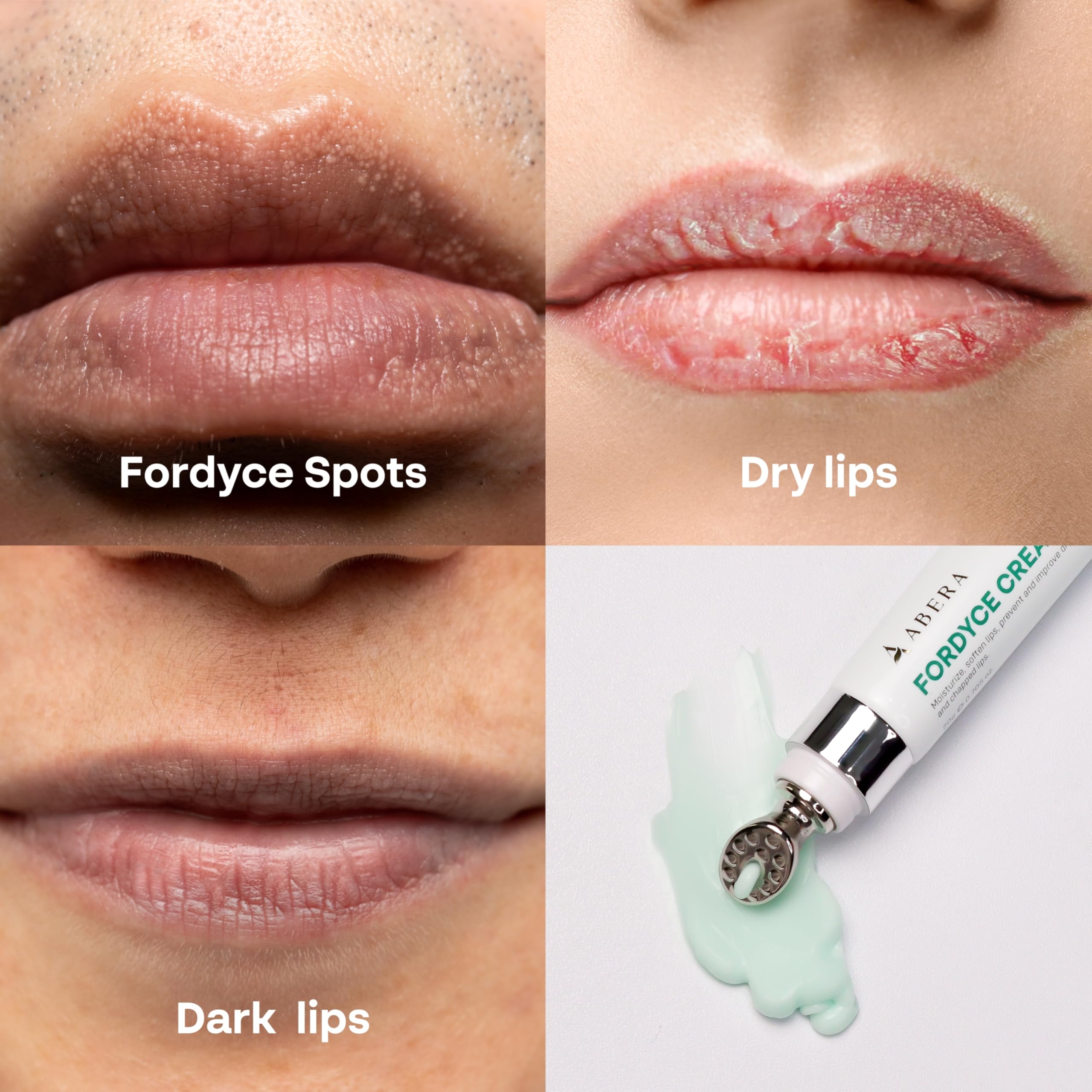 ABERA Fordyce Cream with shea butter nourishes cracked lips