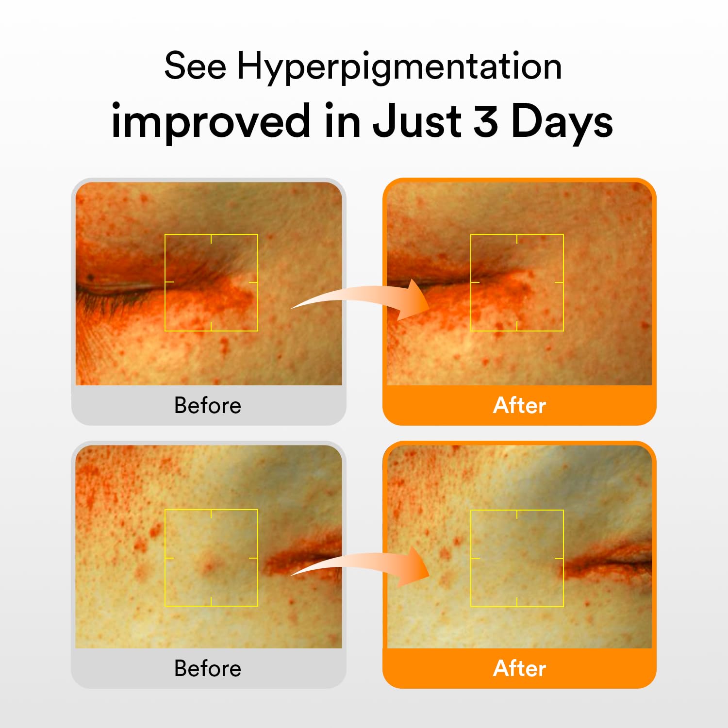 Abib Glutathiosome spot-correction application enables targeted improvement of discoloration.