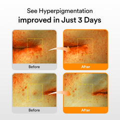 Abib Glutathiosome spot-correction application enables targeted improvement of discoloration.