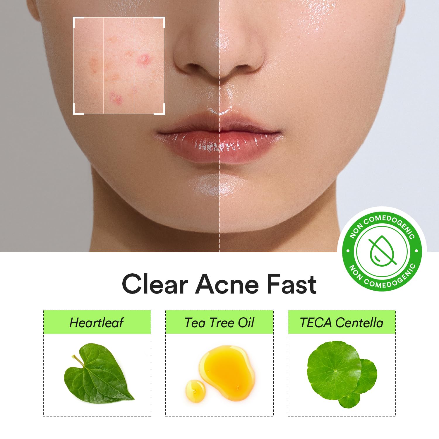 Abib Heartleaf Calming Spot Patch 10mm close-up for early pimples.