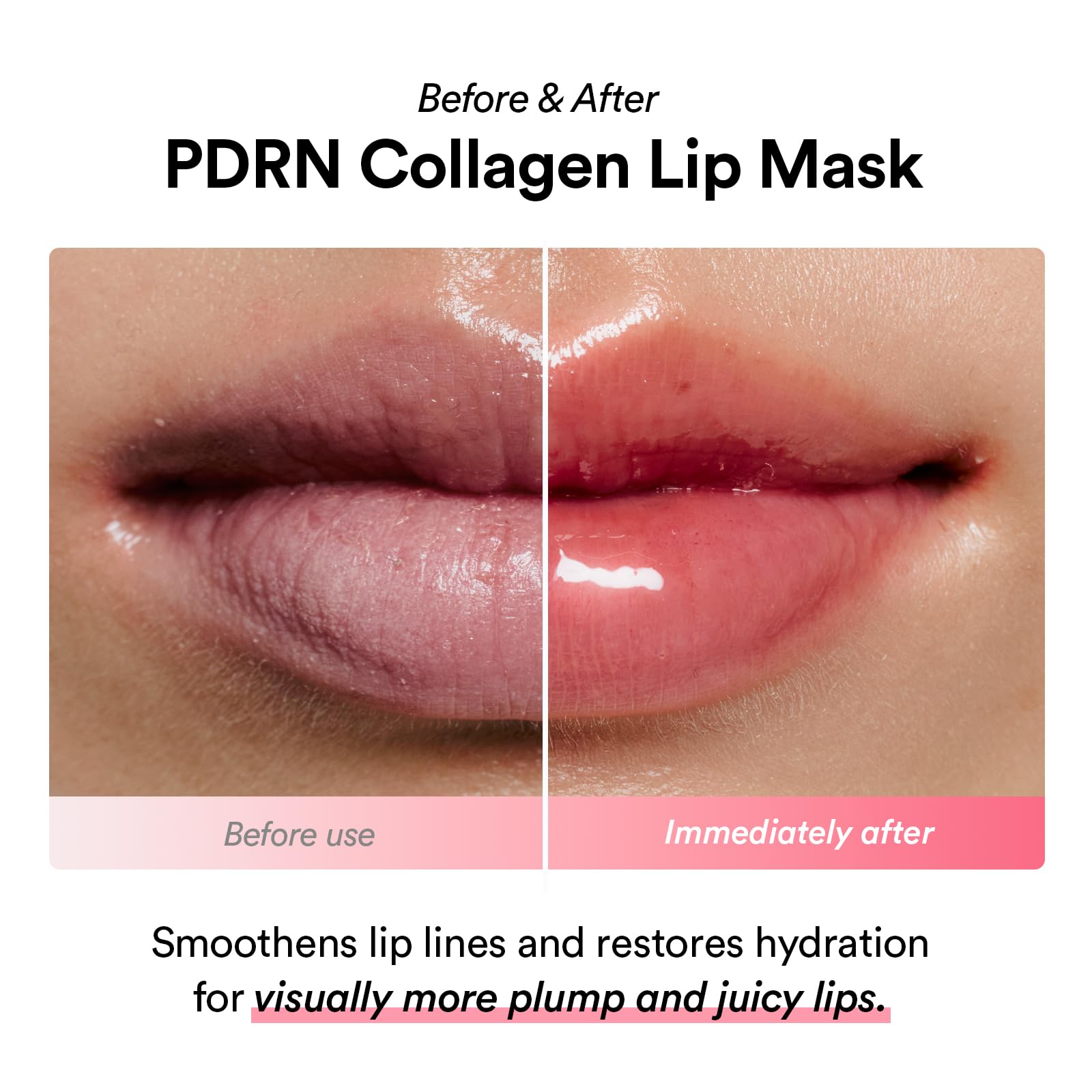Abib PDRN Collagen Lip Mask glazed jelly on lips with shine.