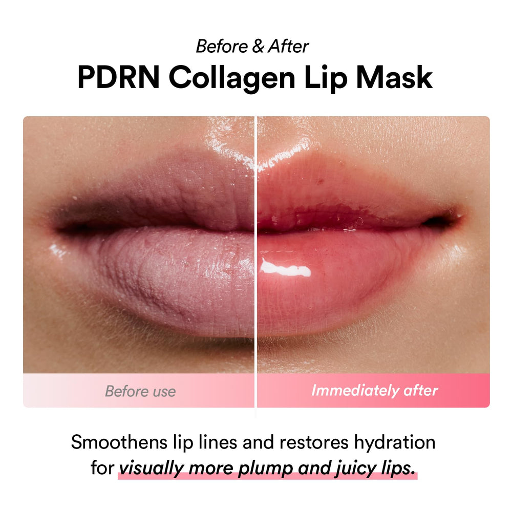 Abib PDRN Collagen Lip Mask glazed jelly on lips with shine.