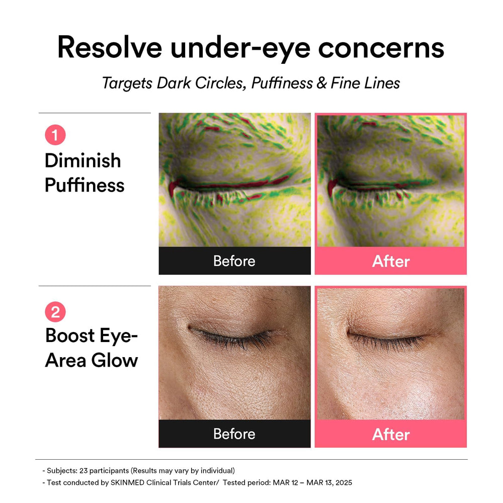 Abib PDRN retinal eye patch closeup texture highlights gentle cooling and moisture lock.