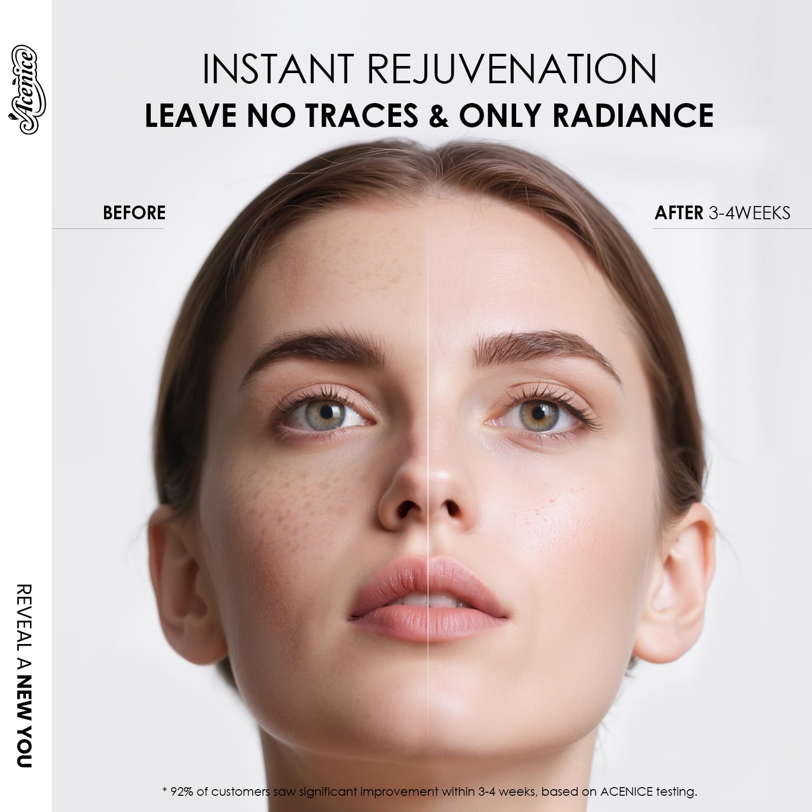 ACENICE TXA+Niacinamide 15% Glow Serum application on face demonstrating quick absorption
