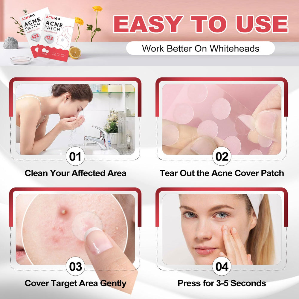 AcneGo patches for all skin types provide a protective barrier while absorbing pus and fluids.